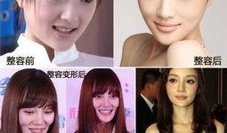 杭州整形爆料事件视频,揭秘美容行业潜规则与真实案例